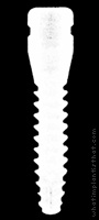 Radiograph of T2 Monoblock