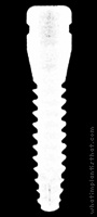Radiograph of T2 Monoblock