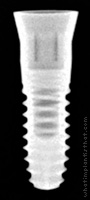 Radiograph of T3 Tissue Level