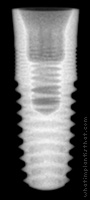 Radiograph of T3 Tissue Level