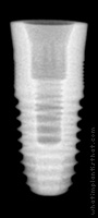 Radiograph of T3 Tissue Level