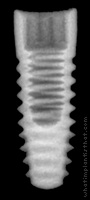 Radiograph of T4 Bone Level