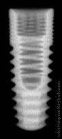 Radiograph of T4 Bone Level