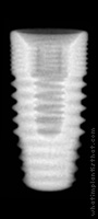 Radiograph of T4 Bone Level