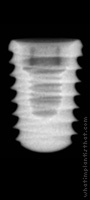 Radiograph of T5 Short