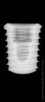 Radiograph of T5 Short