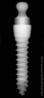 Radiograph of Osstem MS Denture 2.0mm G/H