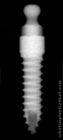 Radiograph of Osstem MS Denture 2.0mm G/H