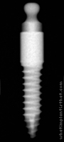 Radiograph of Osstem MS Denture 4.0mm G/H