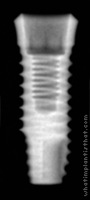 Radiograph of Osstem SS III