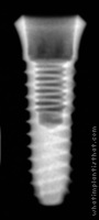 Radiograph of Osstem SS III