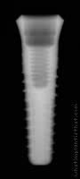 Radiograph of Implance | Tissue Level 4.3