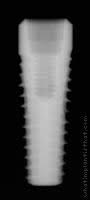 Radiograph of Implance | Tissue Level 4.8