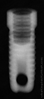 Radiograph of Steri-Oss Flat Top