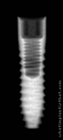 Radiograph of Tapered Internal