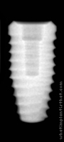 Radiograph of Tapered Internal Plus