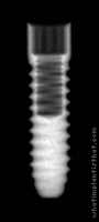 Radiograph of Laser-Lok 3.0