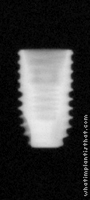 Radiograph of Osstem TSII