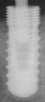 Radiograph of Biolife